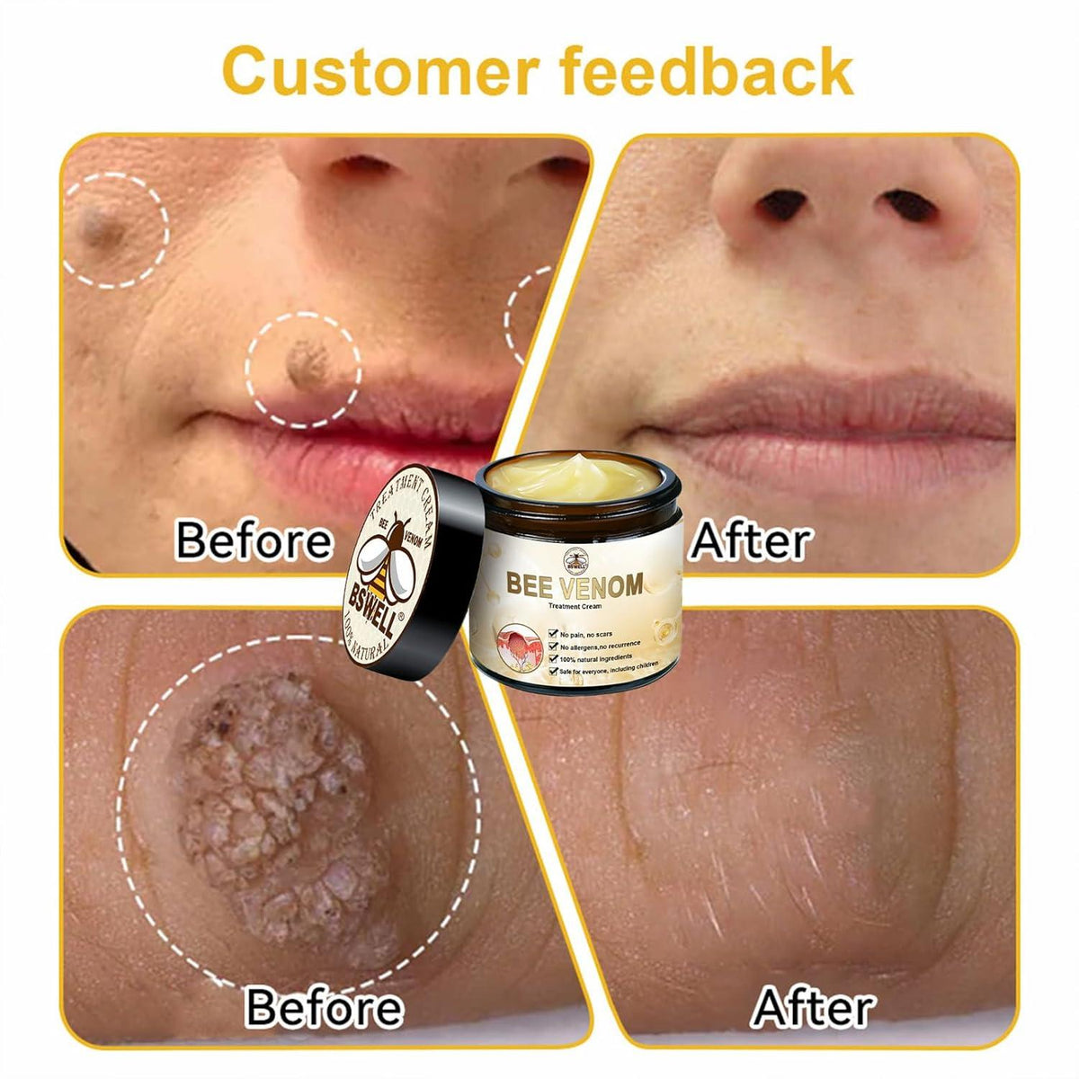 Bee Venom Repair Cream skin application – smoothing and firming anti-aging treatment