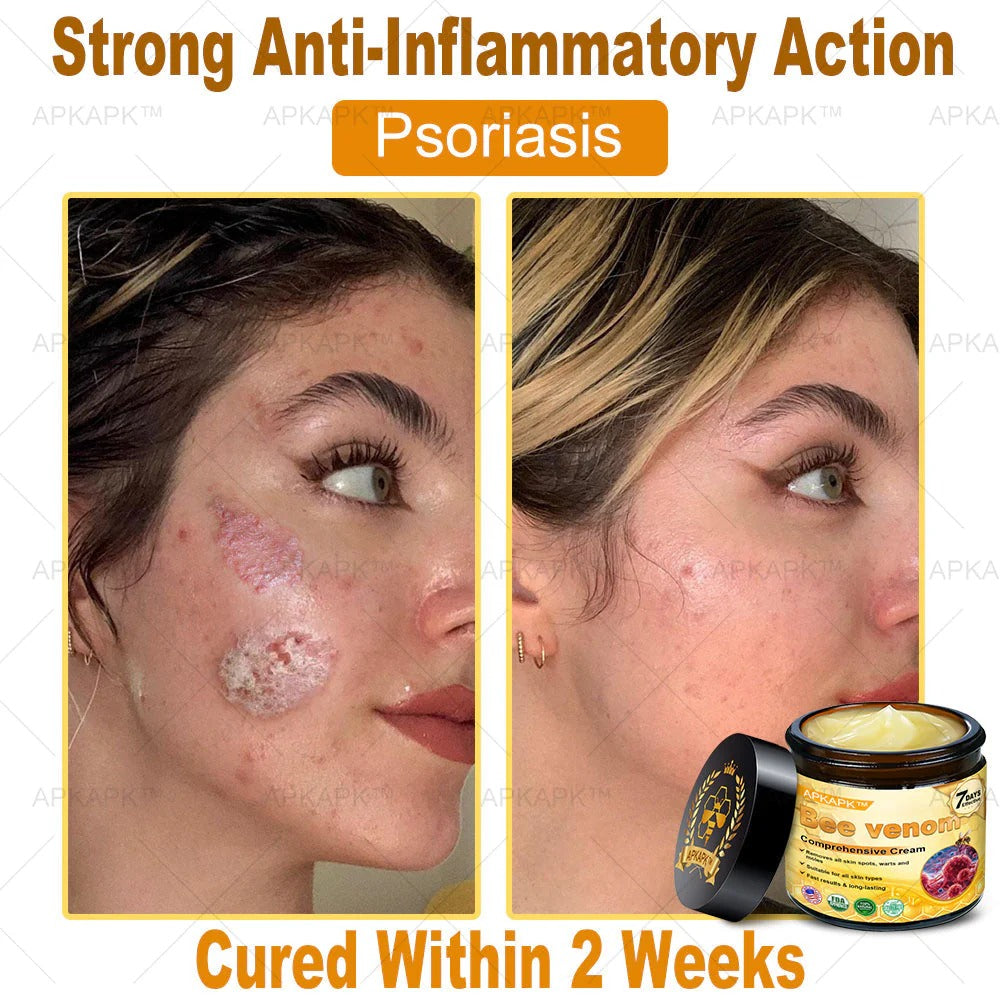 Bee Venom Repair Cream packaging details – skin firming collagen boosting cream